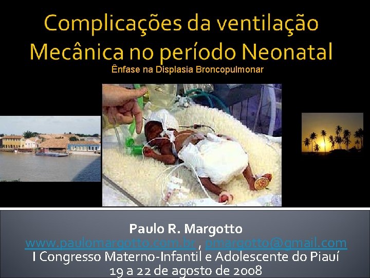 Ênfase na Displasia Broncopulmonar Paulo R. Margotto www. paulomargotto. com. br , pmargotto@gmail. com