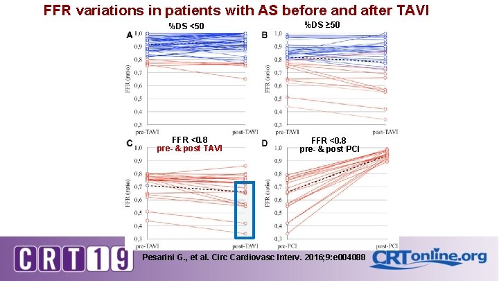 FFR variations in patients with AS before and after TAVI %DS <50 FFR <0.