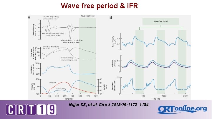 Wave free period & i. FR Nijjer SS, et al. Circ J 2015; 79: