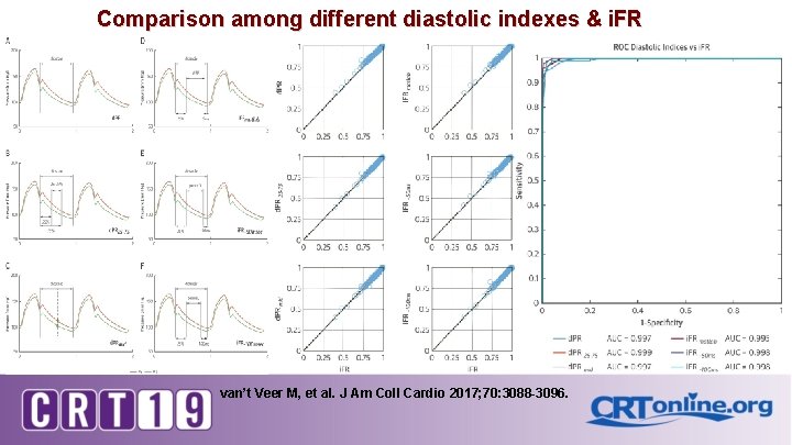 Comparison among different diastolic indexes & i. FR van’t Veer M, et al. J