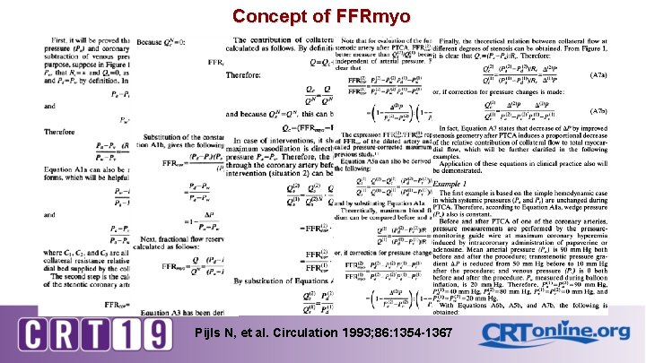 Concept of FFRmyo Pijls N, et al. Circulation １ 993; 86: 1354 -1367 