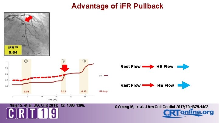 Advantage of i. FR Pullback Nijjer S, et al. JACCint 2014; 12: 1386 -1396.