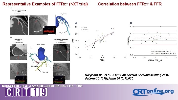 Representative Examples of FFRCT (NXT trial) Correlation between FFRCT & FFR Nørgaard BL, et
