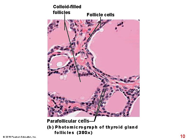 Colloid-filled follicles © 2018 Pearson Education, Inc. Follicle cells Parafollicular cells (b) Photomicrograph of