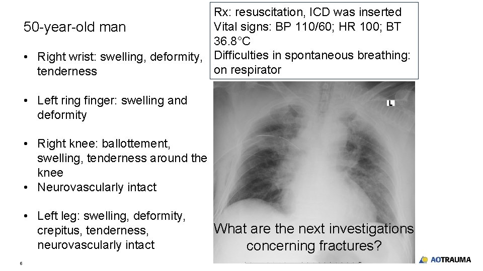 Rx: resuscitation, ICD was inserted Vital signs: BP 110/60; HR 100; BT 50 -year-old Rx: resuscitation, ICD was inserted Vital signs: BP 110/60; HR 100; BT 50 -year-old