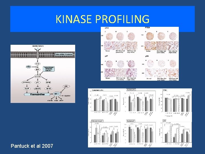 KINASE PROFILING Pantuck et al 2007 