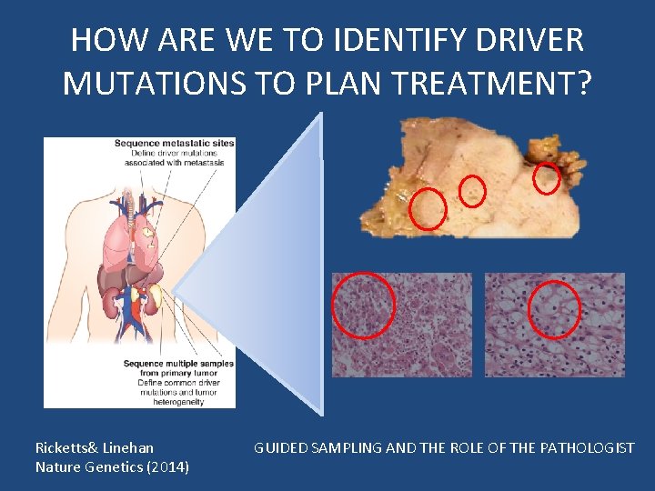 HOW ARE WE TO IDENTIFY DRIVER MUTATIONS TO PLAN TREATMENT? Ricketts& Linehan Nature Genetics