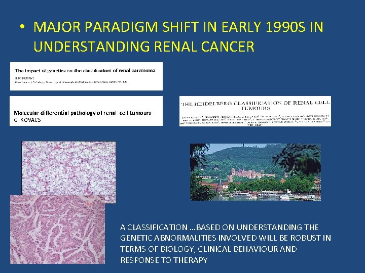  • MAJOR PARADIGM SHIFT IN EARLY 1990 S IN UNDERSTANDING RENAL CANCER Molecular