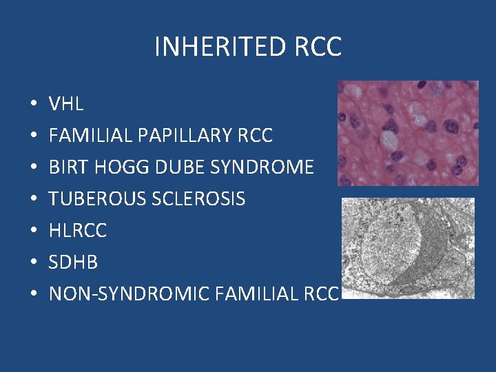 INHERITED RCC • • VHL FAMILIAL PAPILLARY RCC BIRT HOGG DUBE SYNDROME TUBEROUS SCLEROSIS