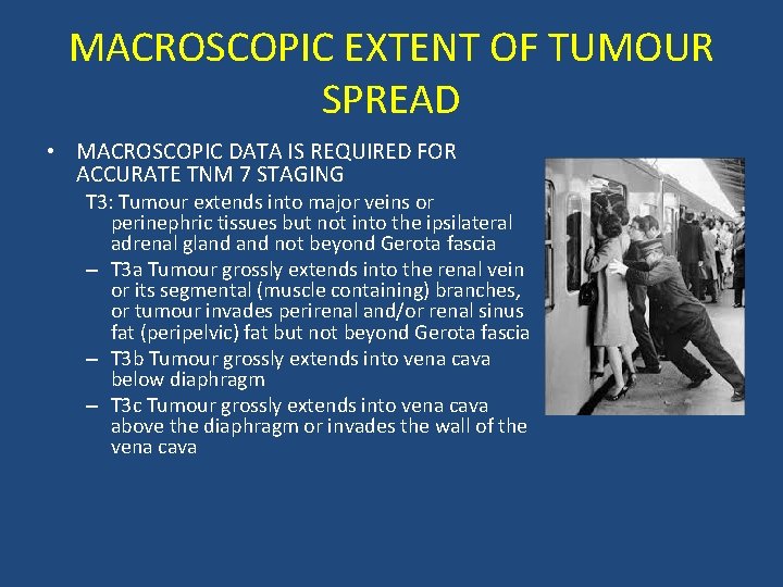 MACROSCOPIC EXTENT OF TUMOUR SPREAD • MACROSCOPIC DATA IS REQUIRED FOR ACCURATE TNM 7