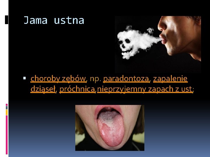 Jama ustna choroby zębów, np. paradontoza, zapalenie dziąseł, próchnica, nieprzyjemny zapach z ust; 