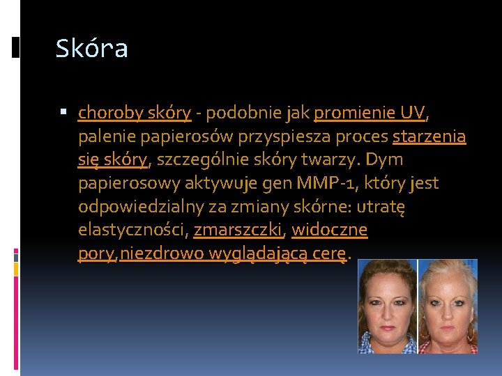 Skóra choroby skóry - podobnie jak promienie UV, palenie papierosów przyspiesza proces starzenia się