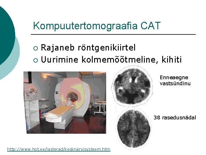 Kompuutertomograafia CAT Rajaneb röntgenikiirtel ¡ Uurimine kolmemõõtmeline, kihiti ¡ Enneaegne vastsündinu 38 rasedusnädal http: