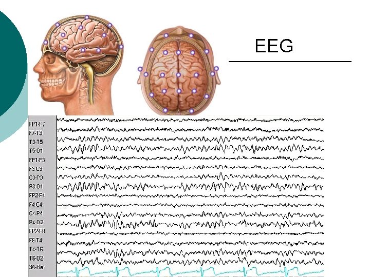 EEG 