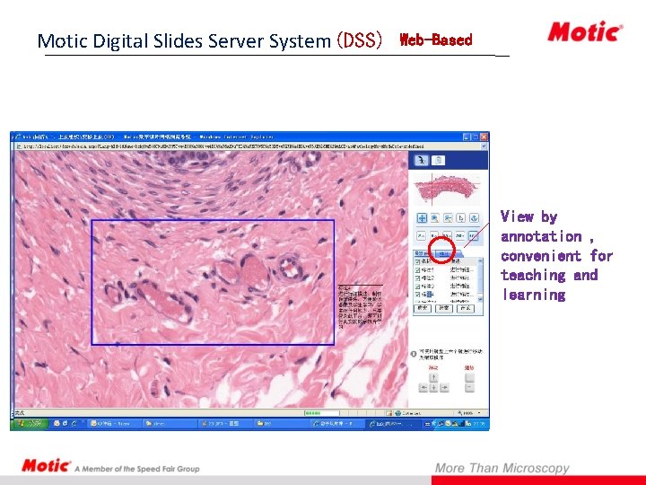 Motic Digital Slides Server System(DSS) System Web-Based View by annotation , convenient for teaching