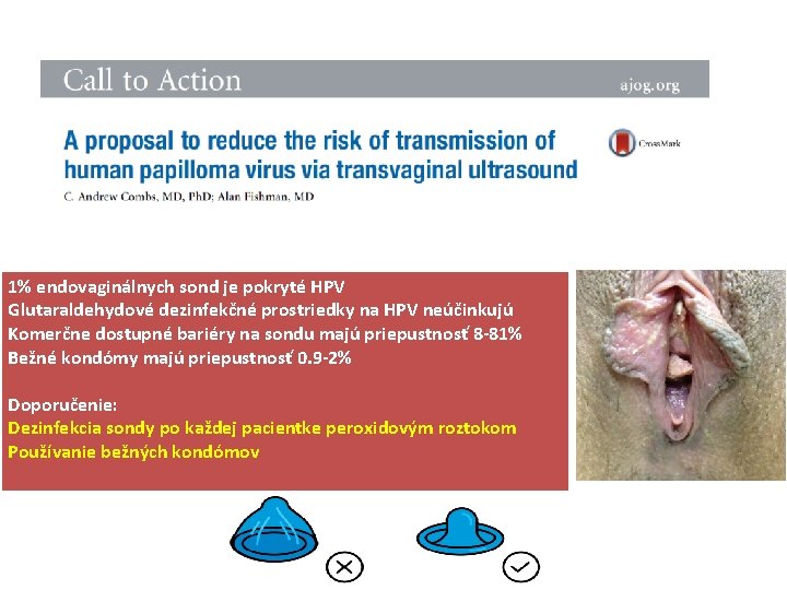 1% endovaginálnych sond je pokryté HPV Glutaraldehydové dezinfekčné prostriedky na HPV neúčinkujú Komerčne dostupné