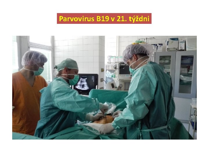 Parvovirus B 19 v 21. týždni 