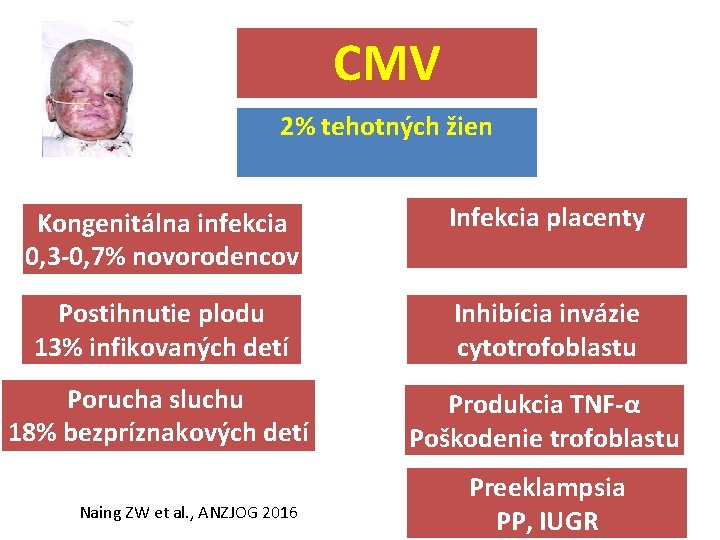 CMV 2% tehotných žien Kongenitálna infekcia 0, 3 -0, 7% novorodencov Infekcia placenty Postihnutie