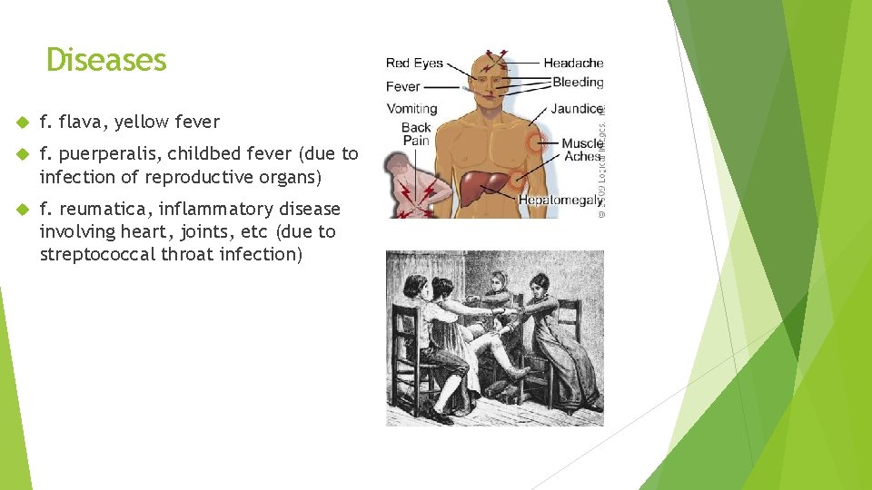 Diseases f. flava, yellow fever f. puerperalis, childbed fever (due to infection of reproductive Diseases f. flava, yellow fever f. puerperalis, childbed fever (due to infection of reproductive