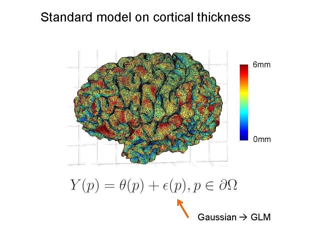 Standard model on cortical thickness 6 mm 0 mm Gaussian GLM 