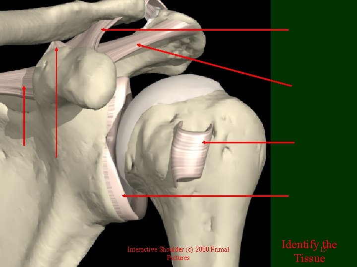 Interactive Shoulder (c) 2000 Primal Pictures Identify 15 the Tissue 