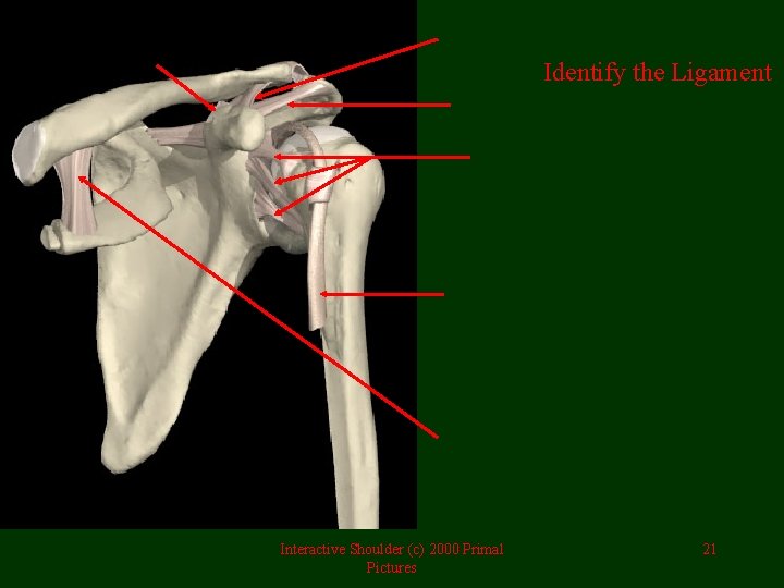 Identify the Ligament Interactive Shoulder (c) 2000 Primal Pictures 21 