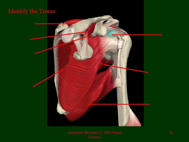 Identify the Tissue Interactive Shoulder (c) 2000 Primal Pictures 29 