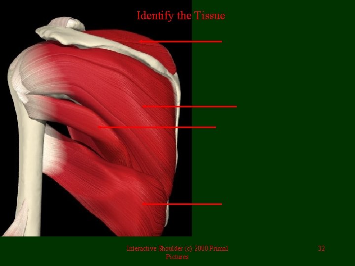 Identify the Tissue Interactive Shoulder (c) 2000 Primal Pictures 32 