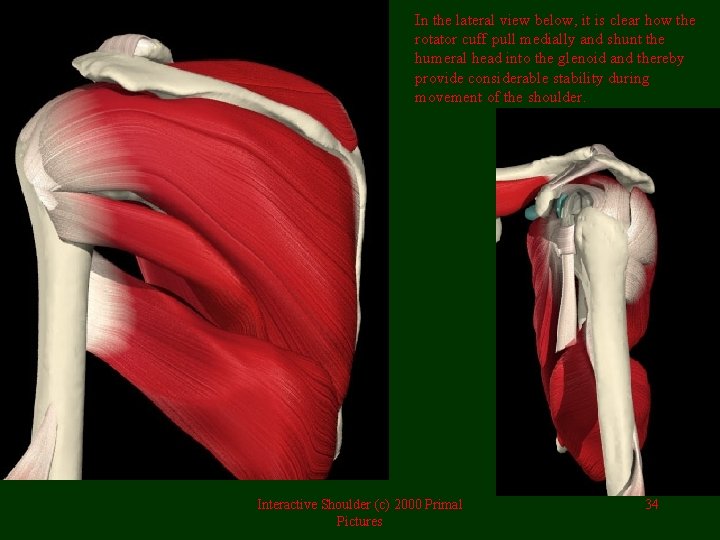 In the lateral view below, it is clear how the rotator cuff pull medially