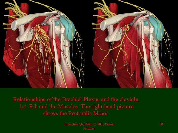 Relationships of the Brachial Plexus and the clavicle, 1 st. Rib and the Muscles.