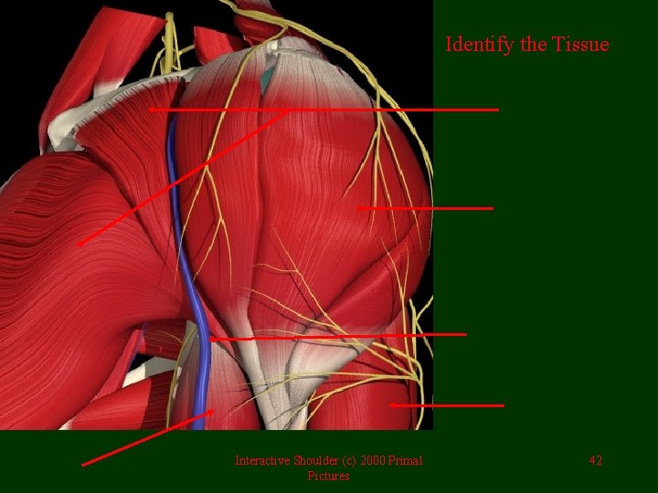Identify the Tissue Interactive Shoulder (c) 2000 Primal Pictures 42 