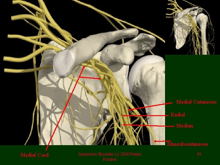 Medial Cutaneous Radial Median Musculocutaneous Medial Cord Interactive Shoulder (c) 2000 Primal Pictures 49