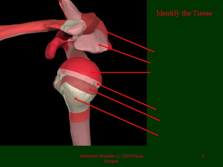 Identify the Tissue Interactive Shoulder (c) 2000 Primal Pictures 6 