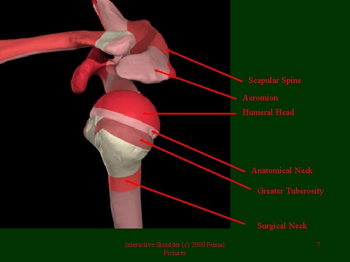 Scapular Spine Acromion Humeral Head Anatomical Neck Greater Tuberosity Surgical Neck Interactive Shoulder (c)