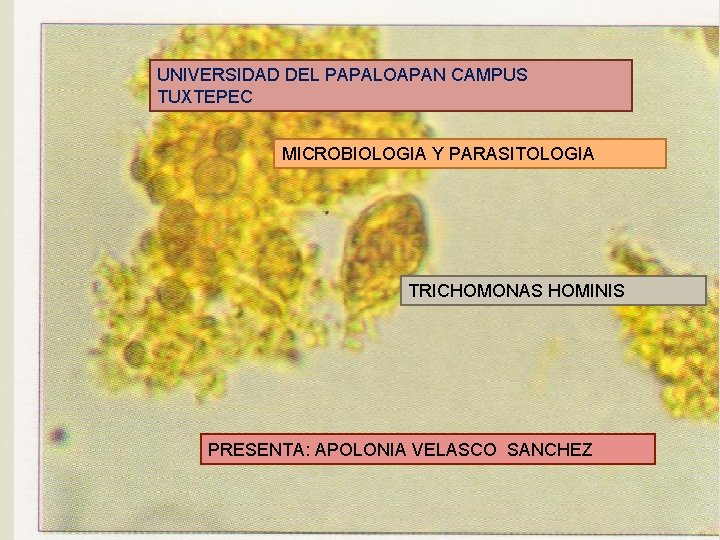 UNIVERSIDAD DEL PAPALOAPAN CAMPUS TUXTEPEC MICROBIOLOGIA Y PARASITOLOGIA TRICHOMONAS HOMINIS PRESENTA: APOLONIA VELASCO SANCHEZ