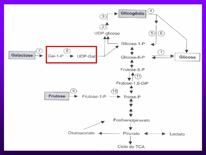 GALACTOSEMIA Ø Deficiência da Galactose-1 -fosfato-UDPtransferase. Ø Autossômica recessiva. Ø Incidência de 1: 50000