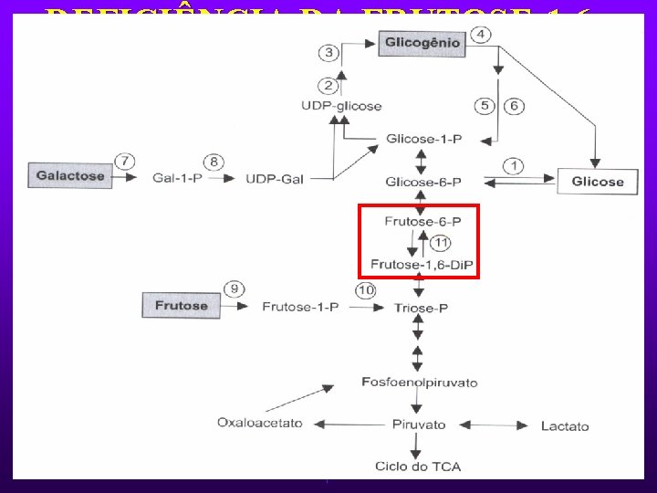 DEFICIÊNCIA DA FRUTOSE-1, 6 DIFOSFATASE Ø Hipoglicemia por jejum ou ingestão de frutose. Ø