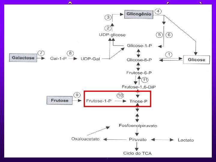 INTOLER NCIA HEREDITÁRIA À FRUTOSE Ø Deficiência de Frutose-1 -fosfato Aldolase. Ø Autossômica recessiva.