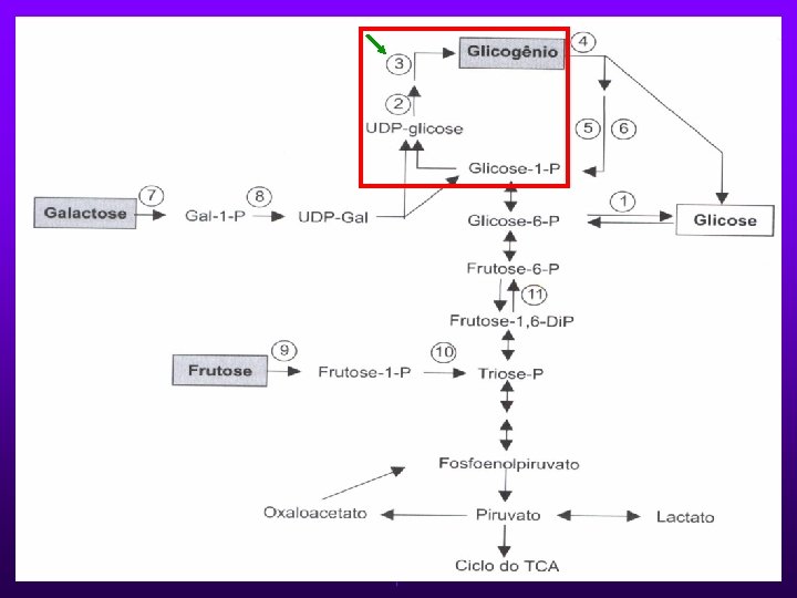 GLICOGENOSE TIPO IV Ø Autossômica recessiva. Ø Forma menos comum. Ø Deficiência da enzima