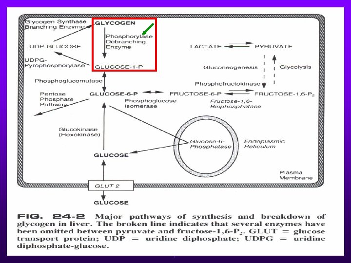 GLICOGENOSE TIPO VI Ø Rara. Ø Deficiência da fosforilase no fígado. Ø Possivelmente seja