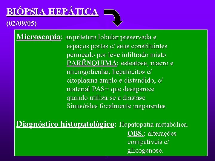 BIÓPSIA HEPÁTICA (02/09/05) Microscopia: arquitetura lobular preservada e espaços portas c/ seus constituintes permeado