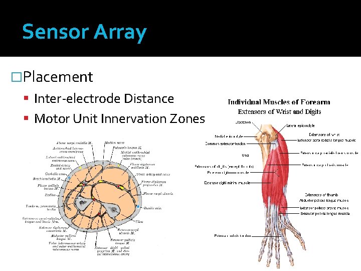 Sensor Array �Placement Inter-electrode Distance Motor Unit Innervation Zones 