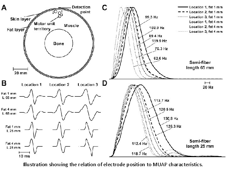 Illustration showing the relation of electrode position to MUAP characteristics. 