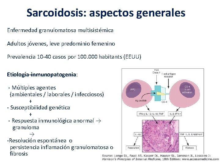 Sarcoidosis: aspectos generales Enfermedad granulomatosa multisistémica Adultos jóvenes, leve predominio femenino Prevalencia 10 -40 Sarcoidosis: aspectos generales Enfermedad granulomatosa multisistémica Adultos jóvenes, leve predominio femenino Prevalencia 10 -40