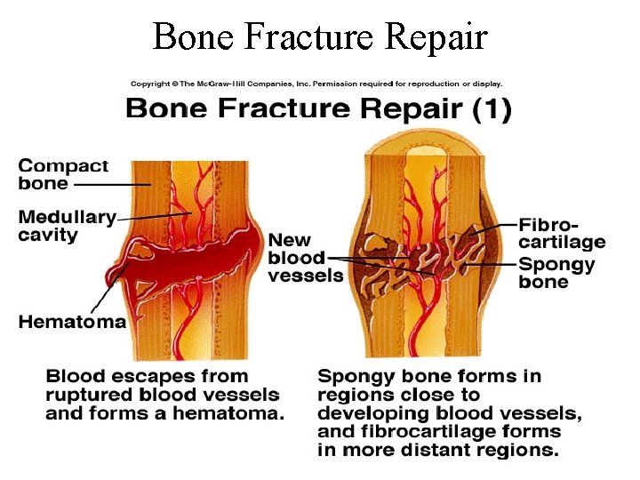 Bone Fracture Repair 