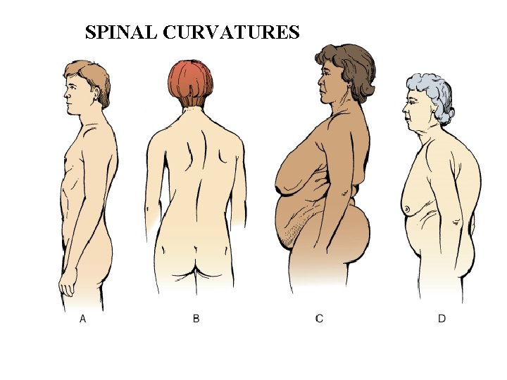 SPINAL CURVATURES 