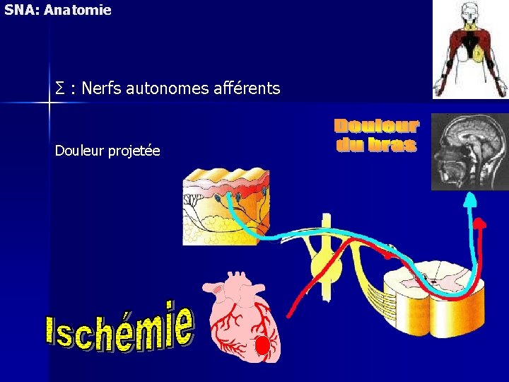 SNA: Anatomie Σ : Nerfs autonomes afférents Douleur projetée 