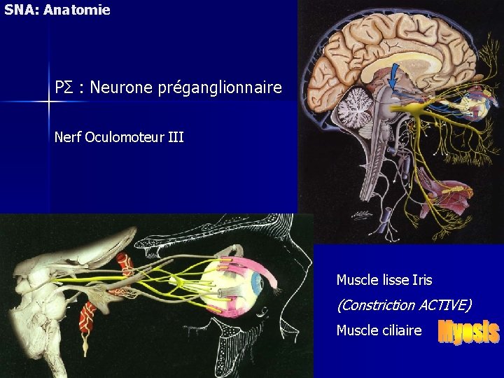 SNA: Anatomie PΣ : Neurone préganglionnaire Nerf Oculomoteur III Muscle lisse Iris (Constriction ACTIVE)