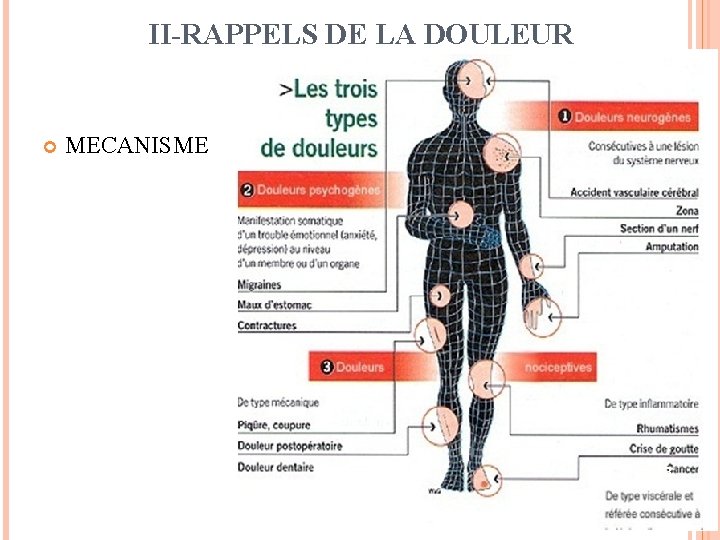 II-RAPPELS DE LA DOULEUR MECANISME 13 