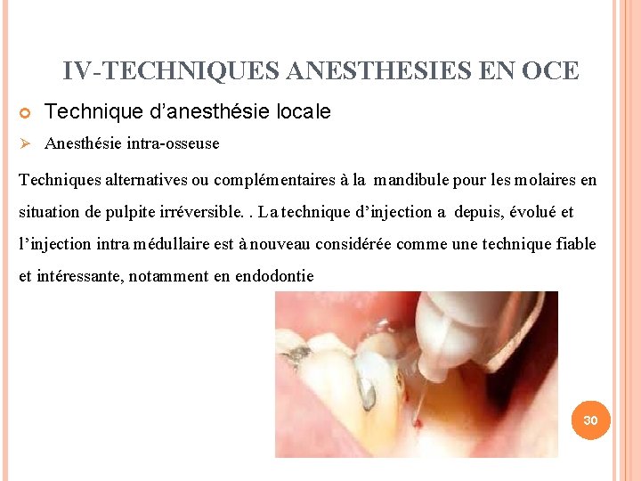 IV-TECHNIQUES ANESTHESIES EN OCE Ø Technique d’anesthésie locale Anesthésie intra-osseuse Techniques alternatives ou complémentaires